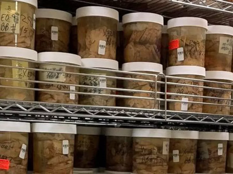 This undated photo shows slices of human brains in the Mount Sinai Brain Bank that researchers are using to study Alzheimer’s disease.